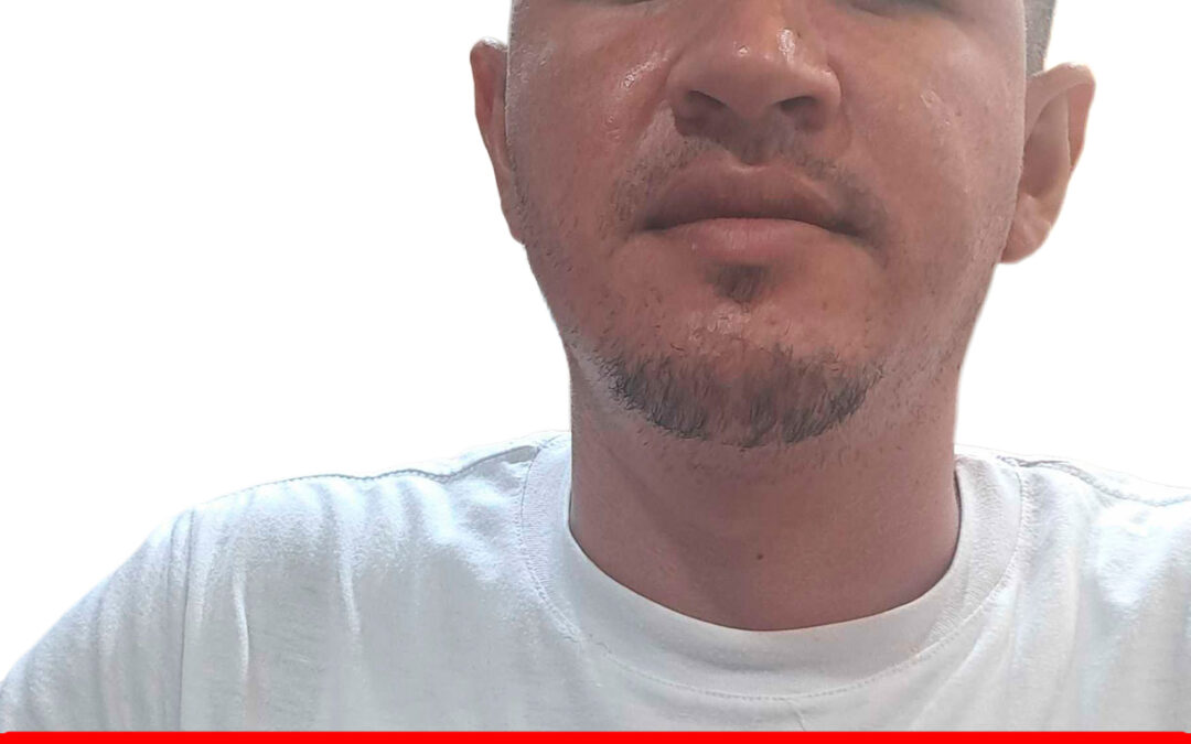 ALBERT NAZARET LUGO RODRIGUEZ