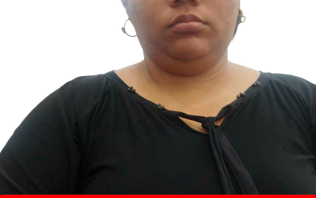 ANYELIS KAROLINA GOMEZ CRESPO