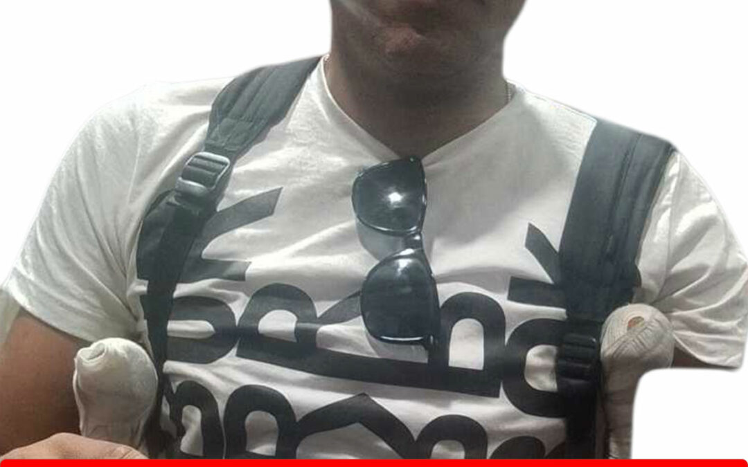 JOHAN ELIAS ASCANIO DONQUIS