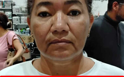 YELITZA ANTONIA CHIRINOS DE NOGUERA