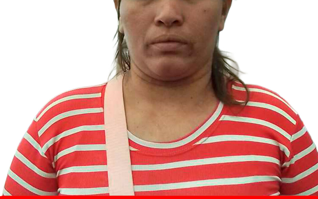 ANNERIS JOSCANY IGARZA GALLEGOS