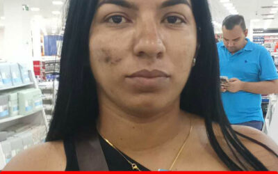 MILITZA DEL CARMEN SANCHEZ VELAZCO