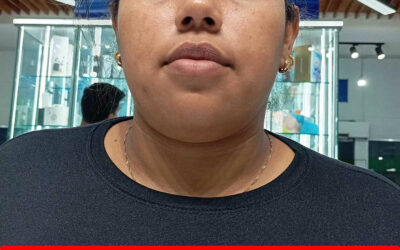 NAIVIC DOUGLEYCIS SANCHEZ ROMERO