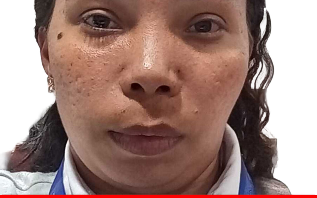 LISBET KARINA TORRES CALZADILLA