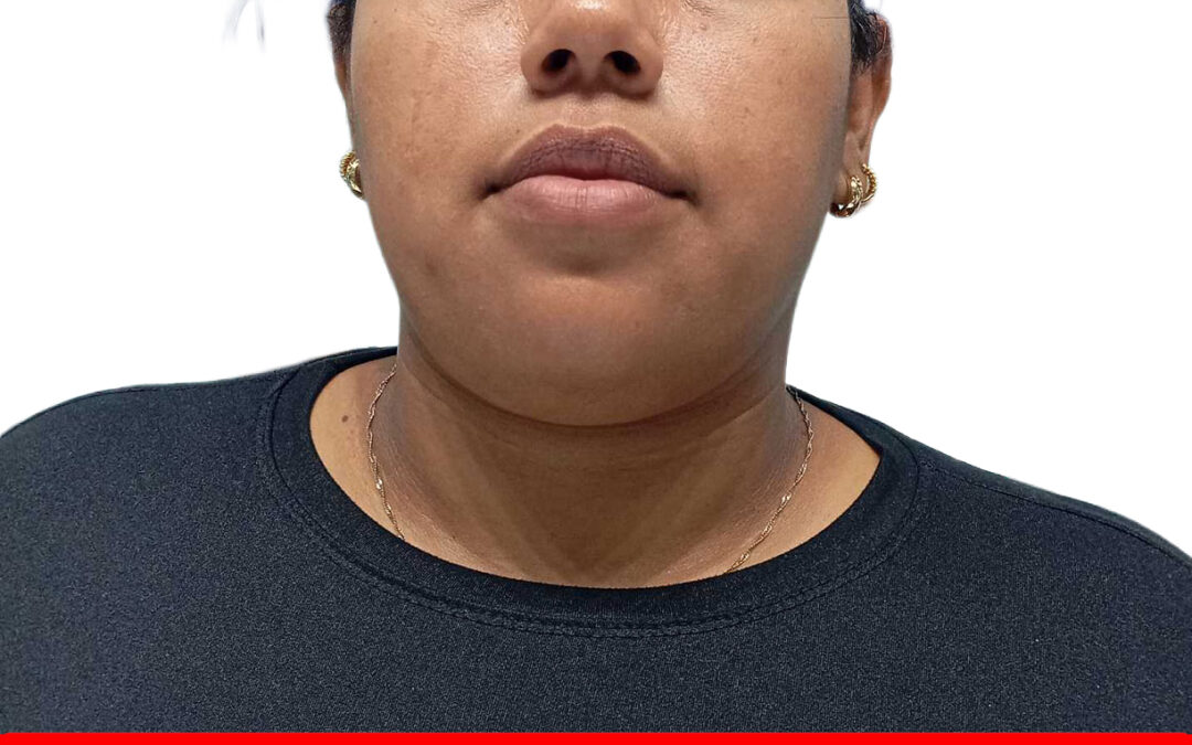 NAIVIC DOUGLEYCIS SANCHEZ ROMERO