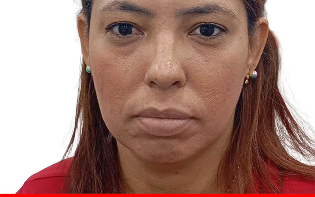 NORYSVELSI CANELON MELENDEZ