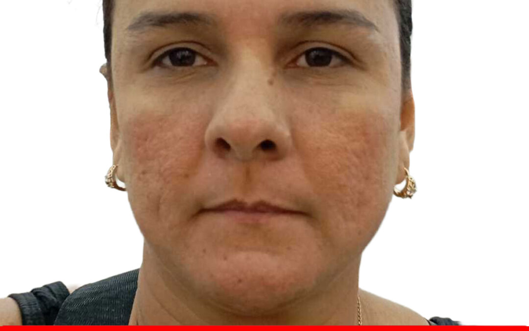 NURELBIS NATHALY YOVERA MARTINEZ