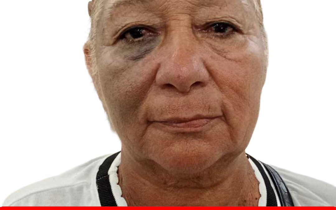 YELITZA JOSEFINA VALLADARES