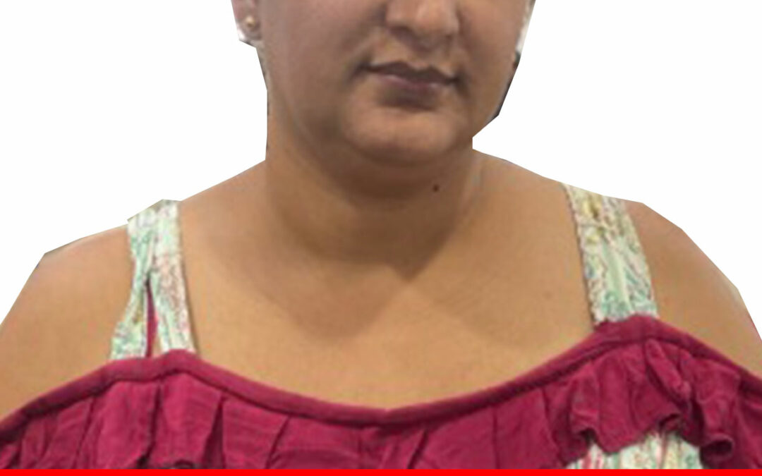 YURIMAR DEL CARMEN CASTILLO MARIN