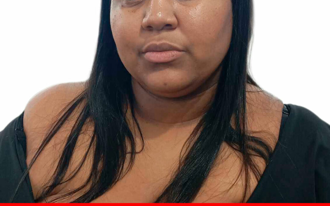 JOHANNY LISHECT ARROYO MEDINA