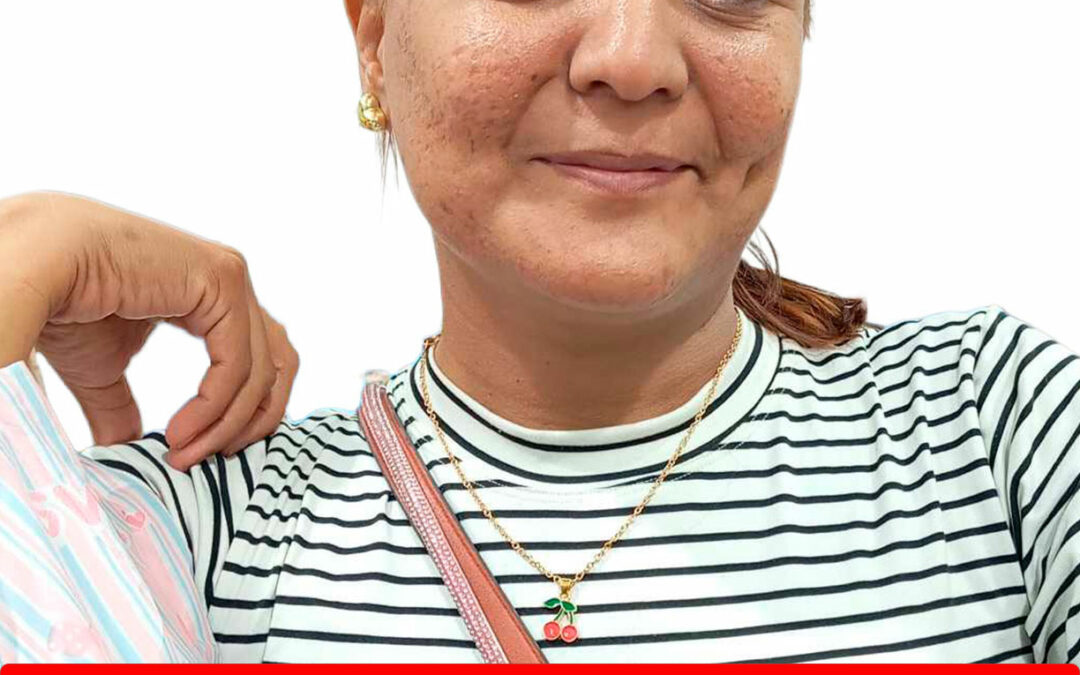 JULIANY NOREIMA MOLINA CAMACHO