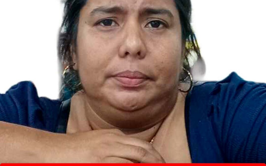 YOLIVERTH JOSE CURUPE