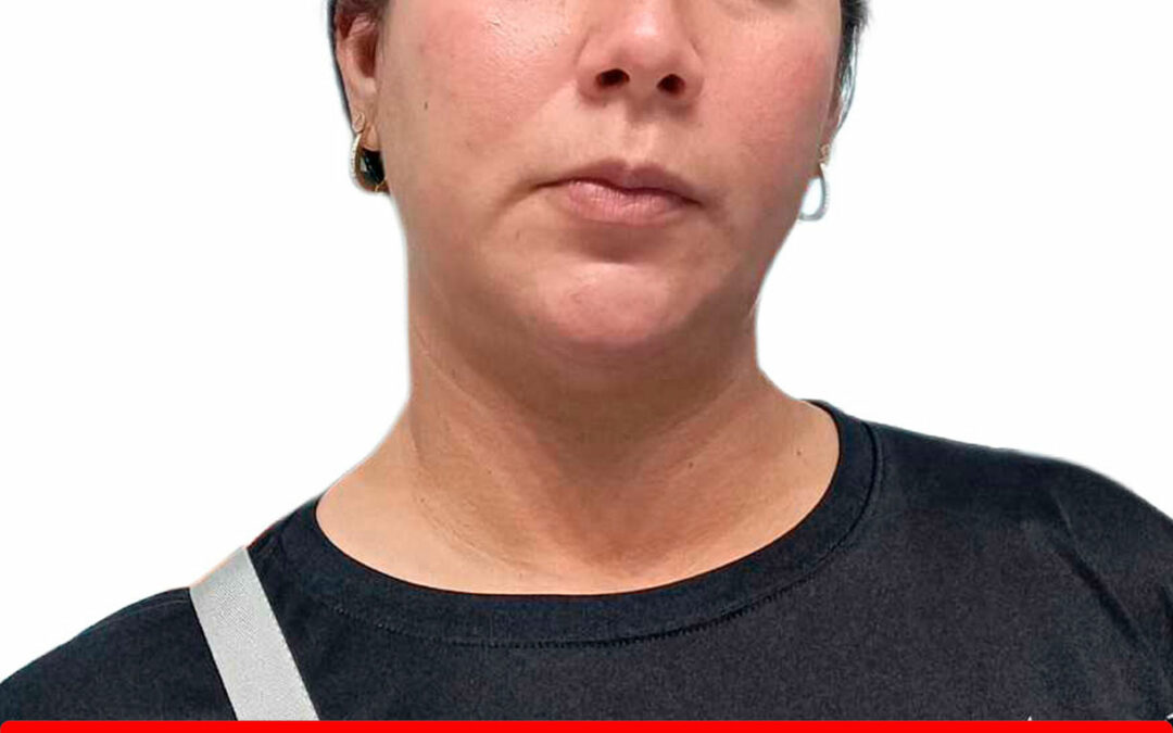 YOSELYN DEL CARMEN ARELLANO BANDRES