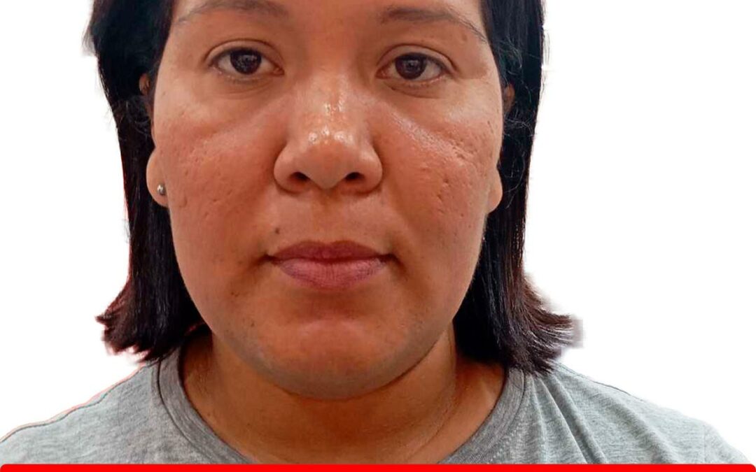 YUSBELIS MERCELIS MATUTE JASPER